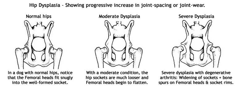 HIP DYSPLASIA